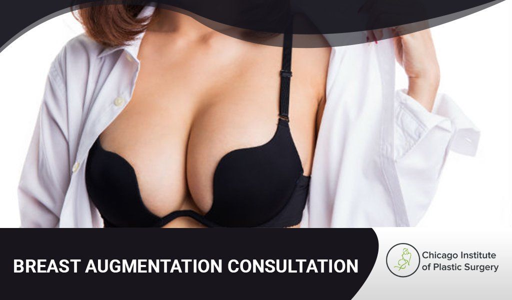 5 Queries Need to Ask During Breast Augmentation Consultation